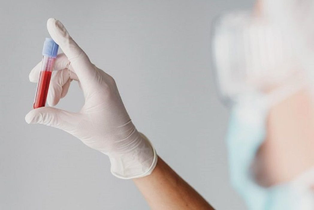 Profissional da saúde usando luvas segura tubo de coleta de sangue em ambiente hospitalar durante exame laboratorial relacionado a doenças infecciosas.